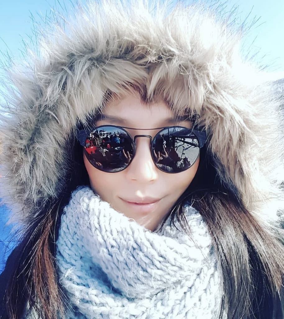 Portrait en hiver avec bonnet à fourrure et écharpe épaisse – souvenir d’un séjour au ski, déclencheur d’une crise d’eczéma.